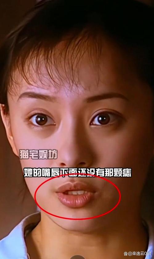 澳门开奖结果开奖记录表013和孙俪唇下痣没了与孙俪嘴唇的痣