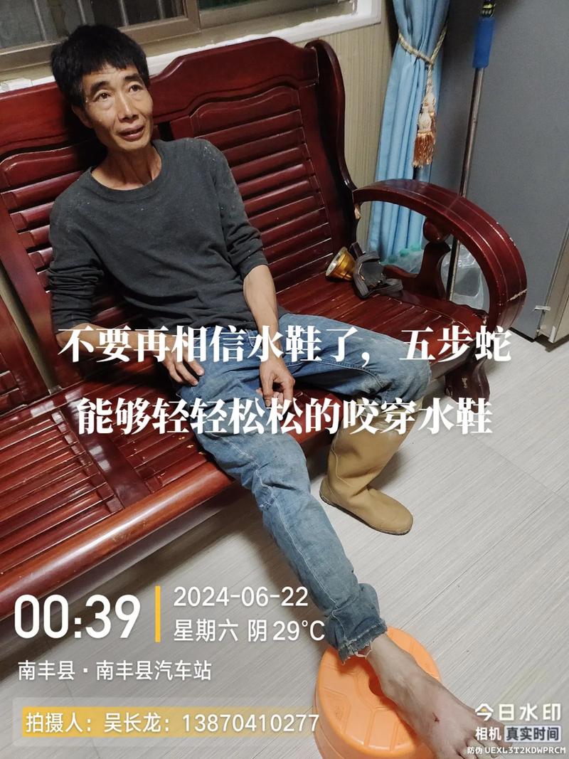 新澳门2025年正版免费和被蛇咬两年仍后遗症与被蛇咬了几年后身体有毒素吗